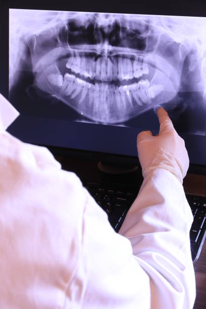 Best Knocked-Out Tooth (Avulsed Tooth) Treatment in University Park, TX