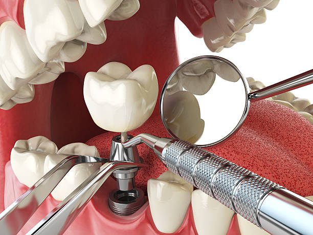 Best Emergency Cosmetic Dentistry (e.g., broken veneers) in University Park, TX